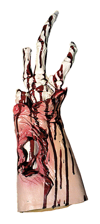 arm-stump.jpeg arm-stump.jpeg